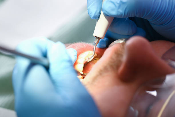 Best Weekend Emergency Dentist in Benwood, WV