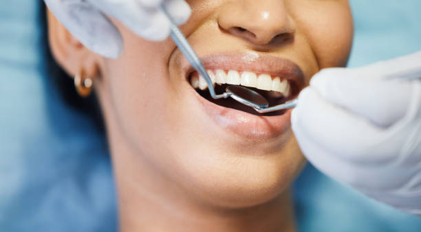 Best Emergency Wisdom Teeth Removal in Benwood, WV